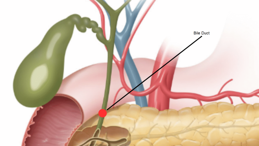 Abdominal Pain